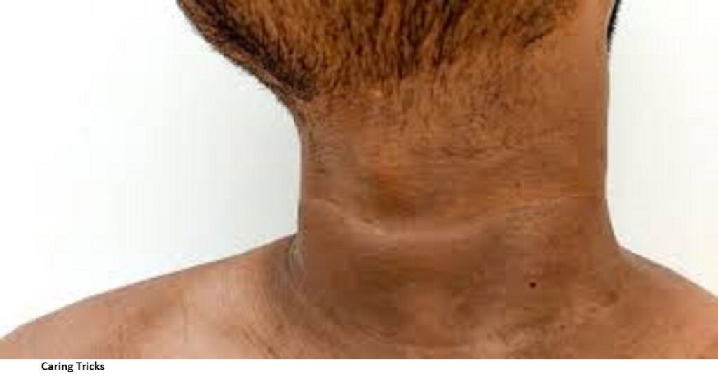 What can I do to get rid of my dark neck